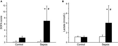 Cellular Mechanisms of Myocardial Depression in Porcine Septic Shock